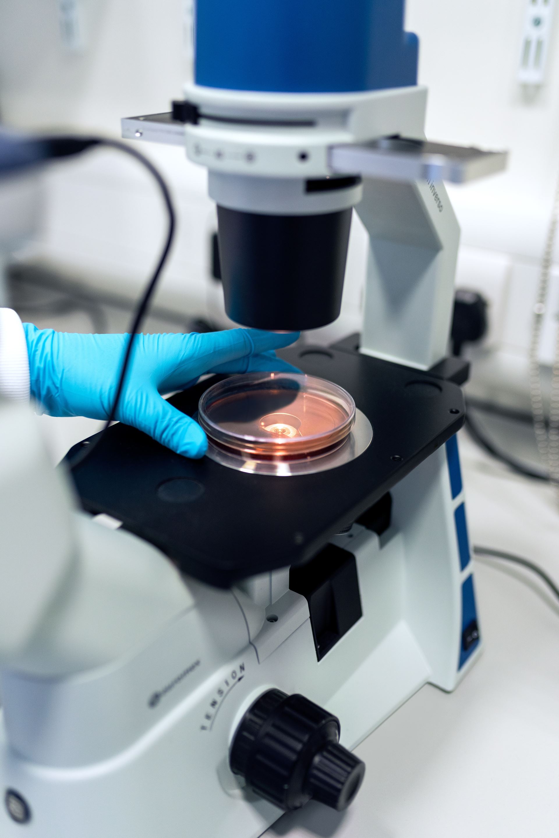 Cervical Screening 